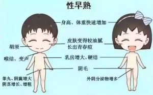 我國(guó)53萬(wàn)兒童性早熟！兒童生長(zhǎng)發(fā)育專(zhuān)家跟您面對(duì)面聊一聊