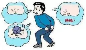 【四院|科普】：大便出血就是得了痔瘡？這6個(gè)肛腸疾病認(rèn)識(shí)誤區(qū)您要知道！